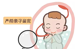 福州产前亲子鉴定预约流程（推荐中鉴中正）